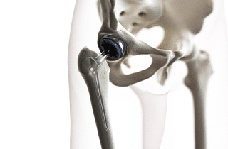 new hip-evolution-physiotherapy
