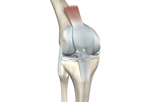 anterior cruciate ligament-evolution physical therapy