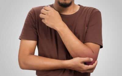 Wij helpen bij blijvende klachten na een gebroken elleboog