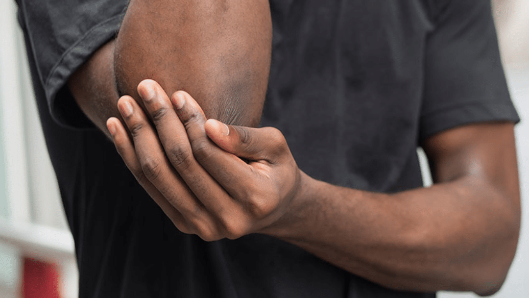 Slijmbeursontsteking-Elleboog