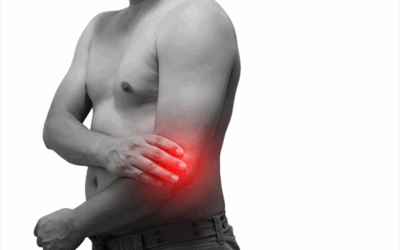 Herstellen met fysiotherapie na een olecranon breuk