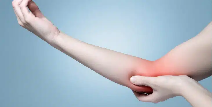 Fase 1 Revalidatie na een capitellumfractuur