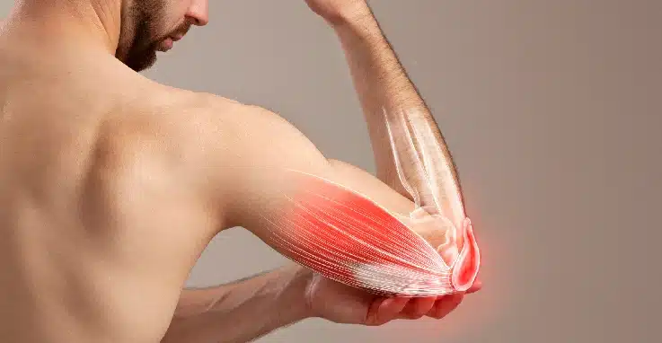 Fase 2 Revalidatie na een capitellumfractuur